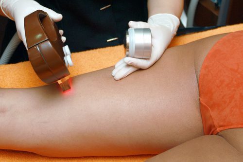 W jaki sposób dbać o świeżo wydepilowaną skórę? Poznaj najnowszy ranking depilatorów
